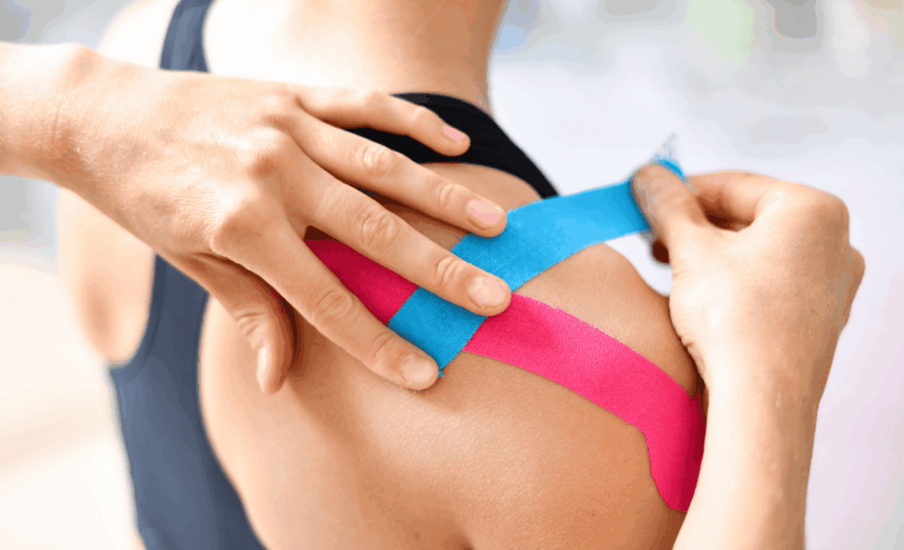 Eine Frau bekommt Kinesiotape aufgeklebt