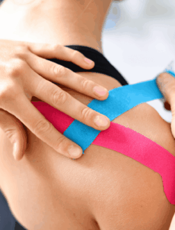 Eine Frau bekommt Kinesiotape aufgeklebt